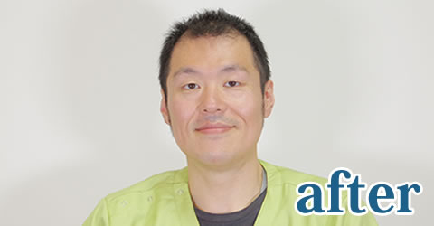 アフター画像