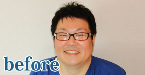 ビフォー画像